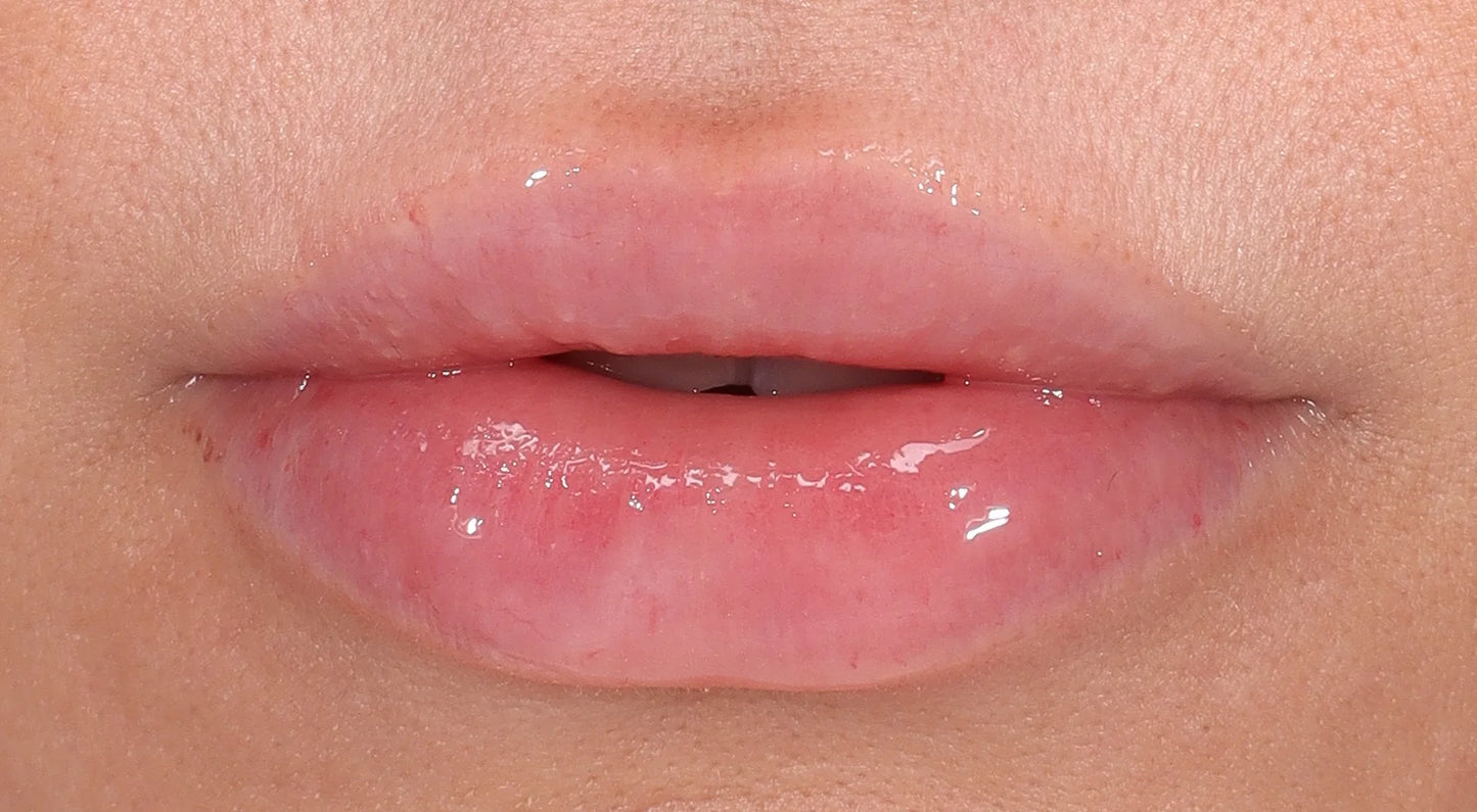 Anfisa Skin Ceramide Lip Treatment